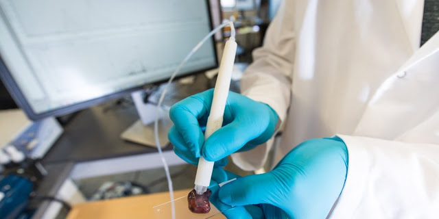 Caneta que detecta câncer começa fase de testes no Brasil