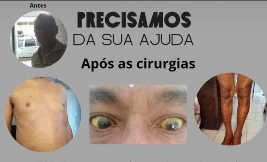 Campanha de Ajuda: Martos Aron Luta por Saúde e Precisa de Exame Urgente