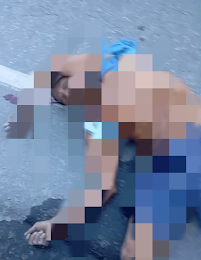 Homem de 42 anos cai de carreta em Senhor do Bonfim e é atendido na UPA.