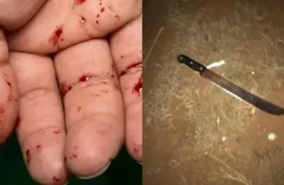 Mulher tem a mão amputada em ataque com terçado no Pará; companheiro está foragido
